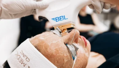 Bbl Laser In Manchester