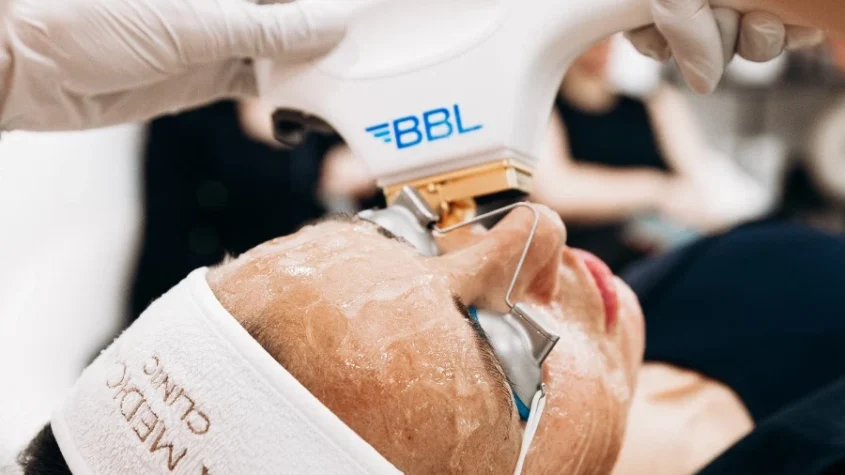 Bbl Laser In Manchester