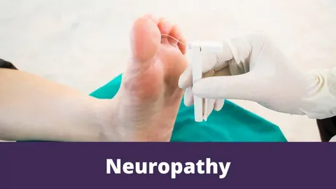 neuropathy support centers